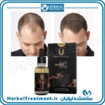 سرم سیر سیاه اصل - سلامتکده ایرانیان