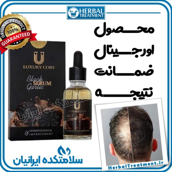 سرم سیر سیاه اصل - سلامتکده ایرانیان