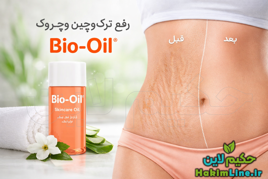 روغن رفع چین و چروک بایو Bio Oil تصویر روغن Bio-Oil Skincare Oil اصل کنار پوست شکم زن، قبل و بعد از استفاده برای کاهش ترک و چین‌وچروک، نشان‌دهنده پوست نرم و سالم، مناسب مقاله سلامتکده و خرید از حکیم‌لاین