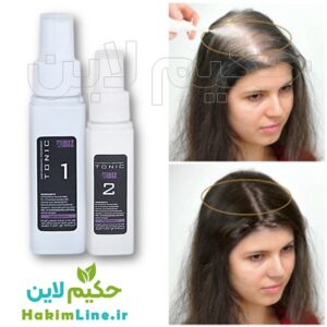 تونیک دوقلوی ضد ریزش و رویش مجدد مو