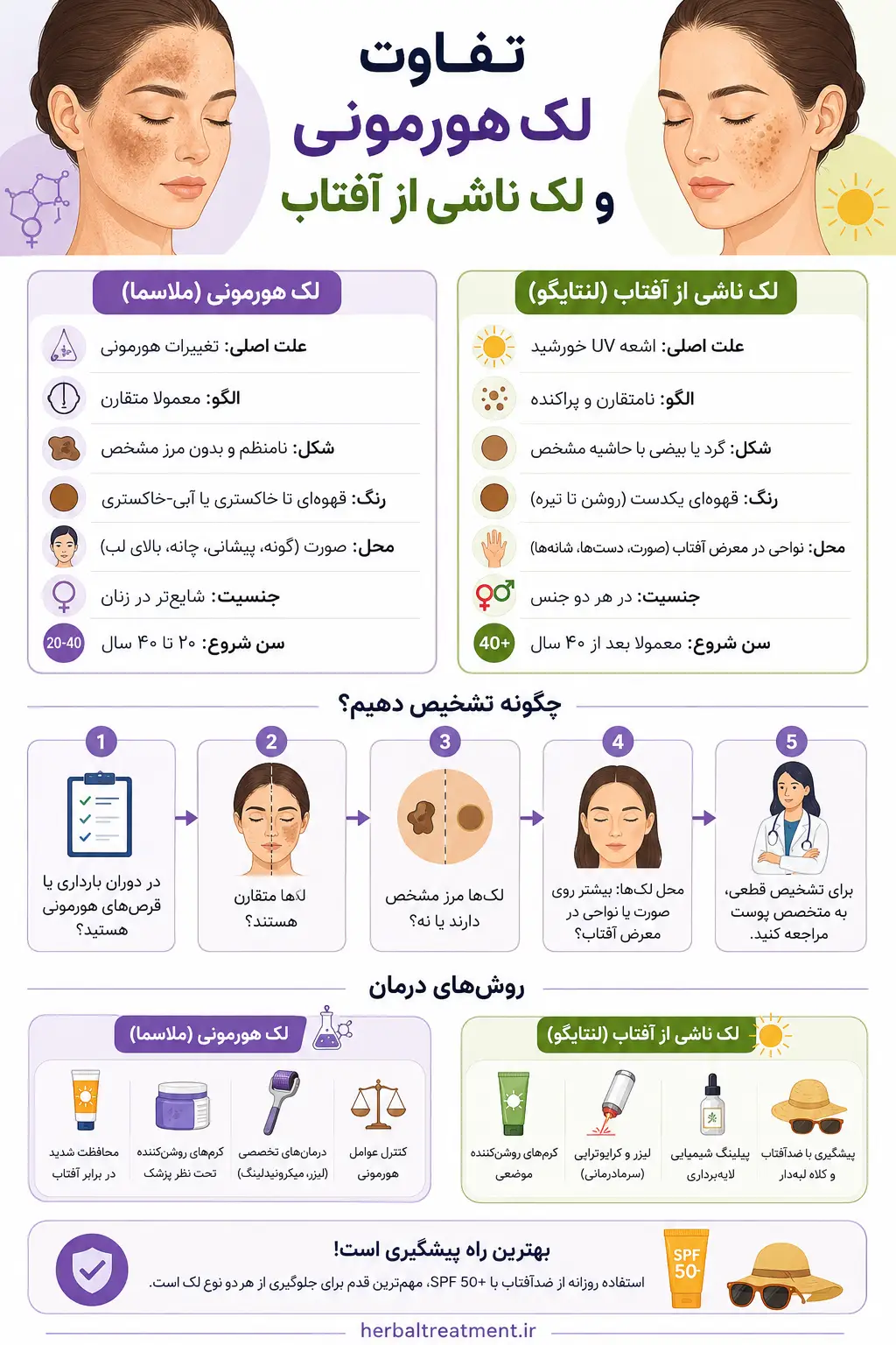 مقایسه کامل تفاوت لک هورمونی و لک ناشی از آفتاب