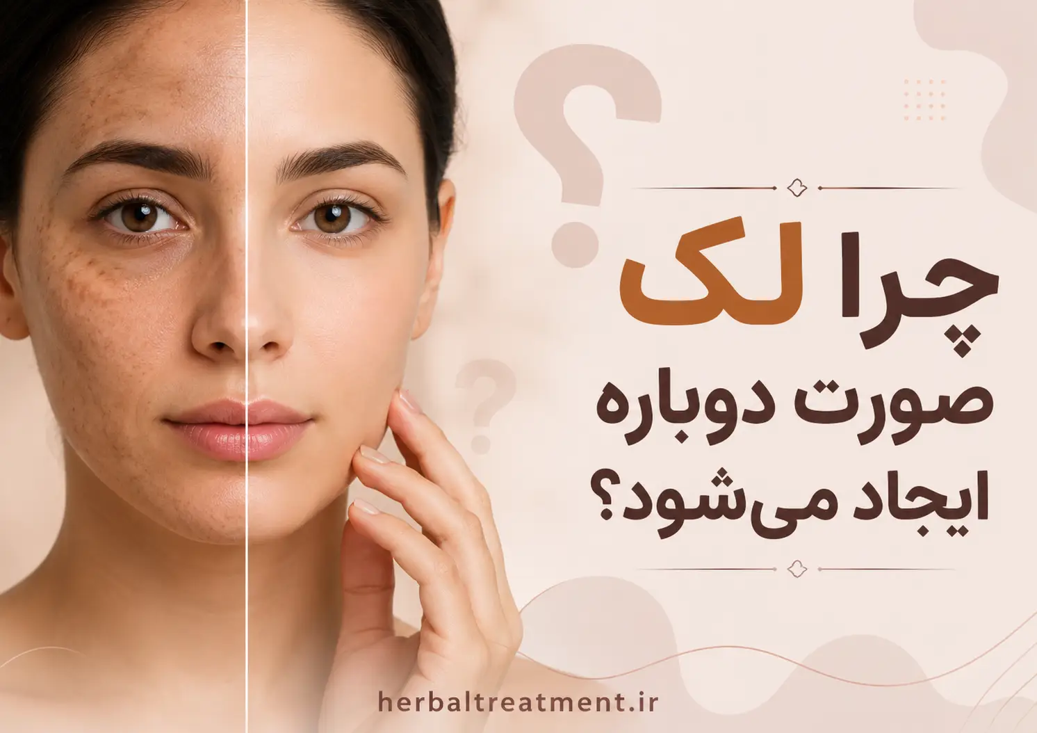 چرا لک صورت دوباره ایجاد میشود؟